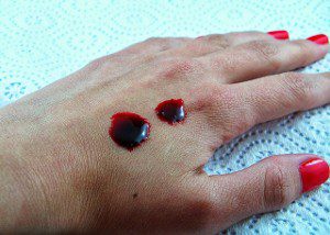 Густая кровь на женской руке
