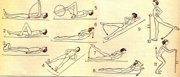 Гимнастика при коксартрозе тазобедренного сустава