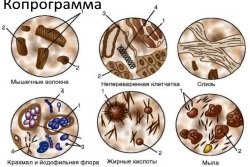 Копрограмма – общий анализ кала - Сравни